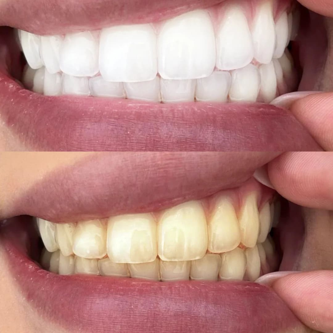 Sonrisa Perfecta